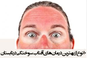 10 نوع از بهترین درمان‌های آفتاب سوختگی در تابستان